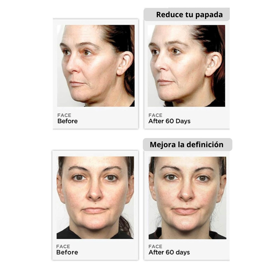 Masajeador Facial Microcorriente